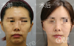 国内做拉皮有名的医生,王志军、祝东升和高亚东哪个好？