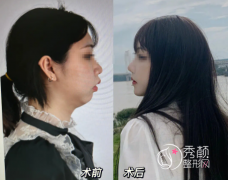 盘点2024全国十大正颌医生，崔荣达、何锦泉、肖林、薛国初等医生上榜