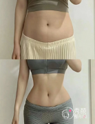 南京抽脂哪里医院比较好？南京康美、艺星、友谊、施而美、美贝尔等医院口碑