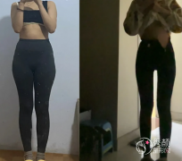 南京吸脂哪个医生好？张让虎、陈孝闯、裴旭芳、黄名斗、林金德等医生口碑好