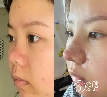 重庆军科整形范文亮隆鼻怎么样，有没有失败案例？