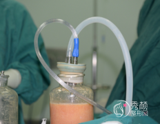 哈尔滨吸脂医生测评：吴垠、张旭光、常维国、谷永安等医生口碑不错