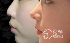 <b>北京混血网红鼻、鼻修复医生盘点：尤建军|刘彦军|王志坚|薛志强等</b>