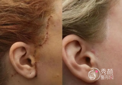 国内拉皮医生前十名排名榜介绍：李晓东、穆宝安、杨大平