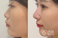 郑州隆鼻医生排行榜前十