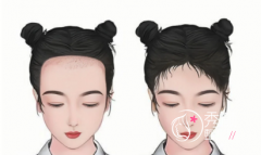 成都植发哪个机构好？华西植发、恒美植发、人民医院植发口碑好！