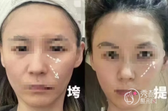 成都八大处面部拉皮手术医生哪个好？侯典举、祁峰、吴乐昊、马晓阳、陈江庭