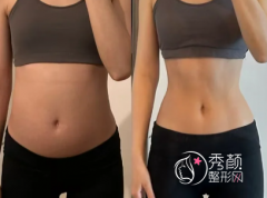 国内吸脂好的医生有哪些