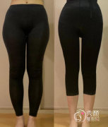 北京直腿术哪个医生好？任学会、李沁奕、齐永乐等医生口碑不错！