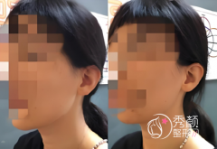 国内磨骨好的医生名单曝