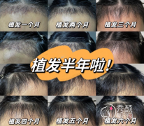 2025上海植发医院技术实力