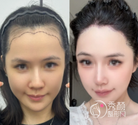 2025广州值得种草的公立植