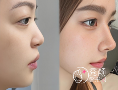 上海做鼻子比较好的医生