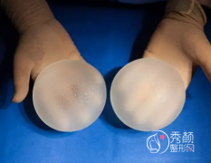 上海假体隆胸医院哪家好