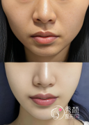 李志海和李湘原谁做磨骨