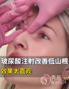 武汉哪个医院打玻尿酸比