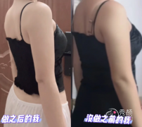 苏州抽脂医院哪家好？美