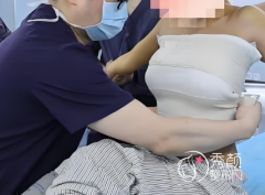 广州做假体隆胸好的医生