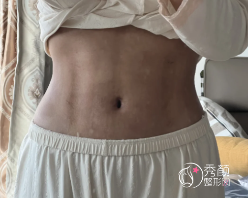 昆明吸脂比较好的医生：郭群|陈宁|何瑞蛟|宋俊辉|王德宁等医生！