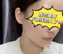 上海吸脂哪家医院好？上