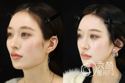 武汉磨骨哪家医院好？武汉磨骨口碑医院+医生介绍