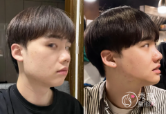 上海磨骨术医院哪家好？