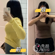 西安缩胸手术哪个医院好