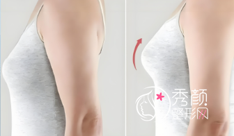 成都隆胸哪个医生好？张雪峰|李正勇|肖海涛|魏家宾|薛瑞|熊猛等