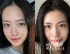 上海植发医院排名榜：上