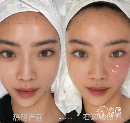 我发现，热玛吉没垮脸的人都有一个共性