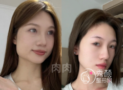 上海磨骨医生大盘点：李