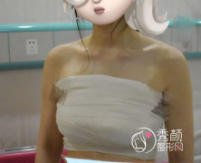 杭州隆胸哪家医院评价好