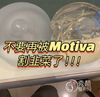 所有人，请不要乱做魔滴motiva假体隆胸……