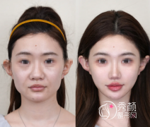 杭州注射微调哪家医院好