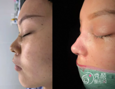 北京隆鼻医生测评，包含