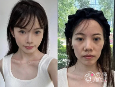 重庆注射微调哪个医生好