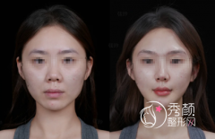 南京注射微调哪个医生好