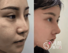 北京鼻修复大咖都有谁？