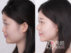 国内隆鼻大佬盘点！这些