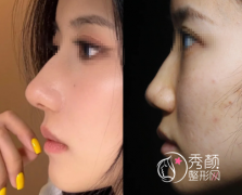 上海隆鼻大佬名单曝光：