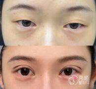 上海双眼皮大佬合集！高