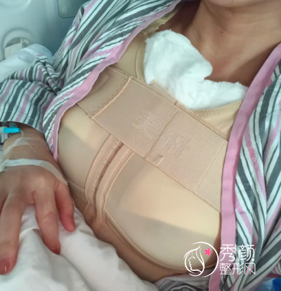 广州隆胸手术哪家医院好？南方医院、中山三院、广医三院…榜上有名