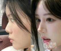 北京鼻综合十大专家：杨