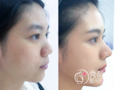 长沙做鼻子医生排行榜：