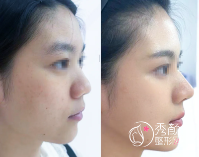 长沙做鼻子医生排行榜：熊宜文、蒋帝时、郑勇、邹俊峰…超热门