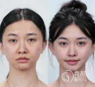 上海微整注射医生哪个好