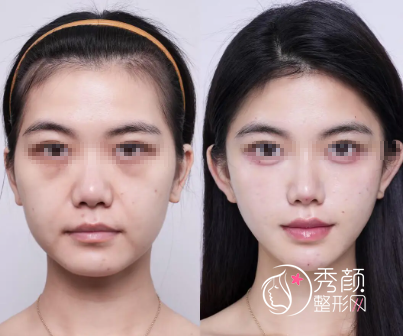 杭州微整注射医生哪个好？李俊霞、郎炜慧、朴洪权…玻尿酸、轮廓固定均有涉及