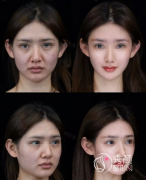 南京微整注射医生哪个好