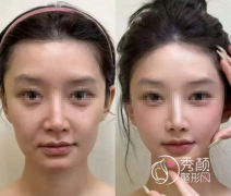 北京微整注射医院哪家好