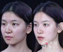 北京微整注射医生哪个好